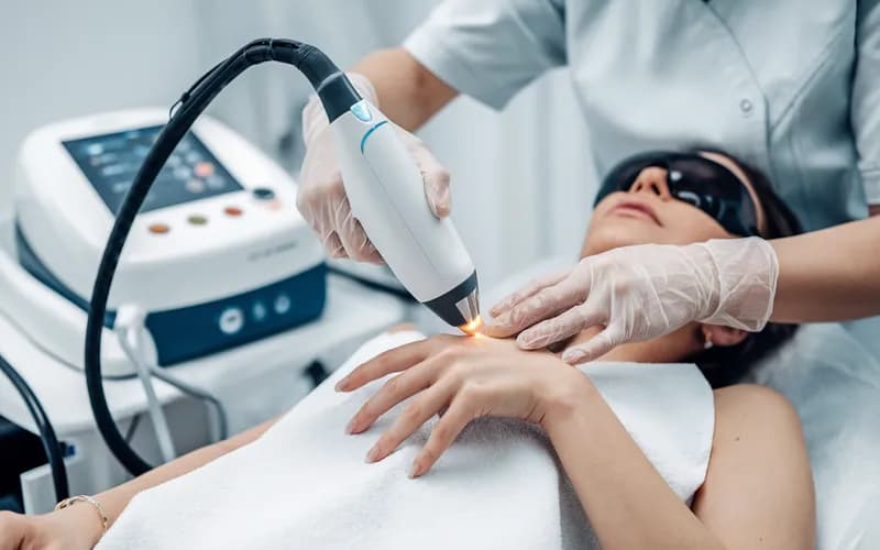 Безболісна лазерна епіляція рук