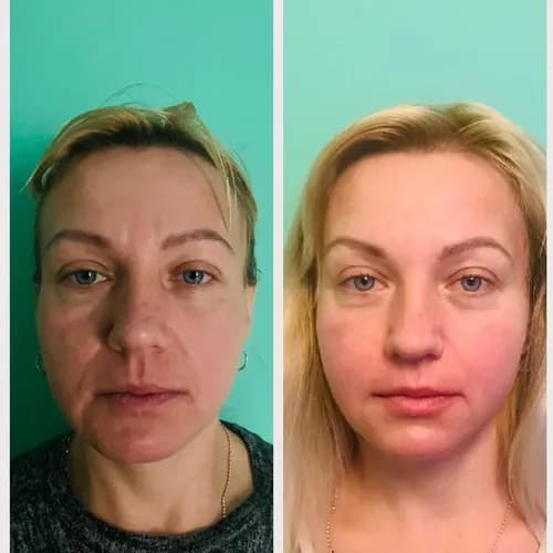 Transformacja bez operacji