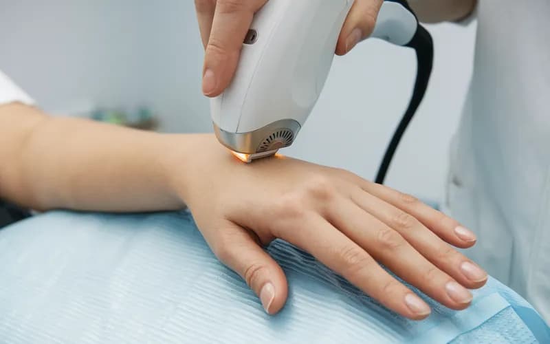 Laserowa pielęgnacja skóry rąk