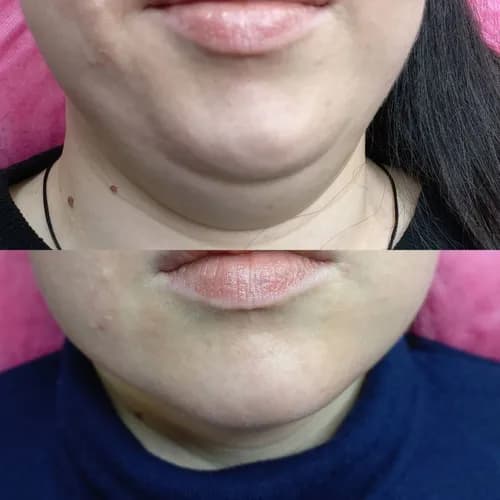 Испанский массаж: лёгкость и комфорт