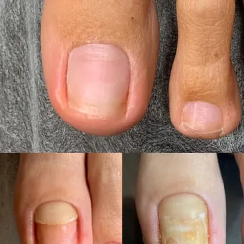 Rekonstrukcja paznokci z naturalnym efektem