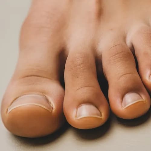 Восстановление и реконструкция ногтей