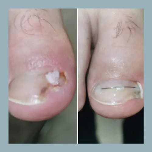 Wymarzone paznokcie - protetyka i pielęgnacja od nas