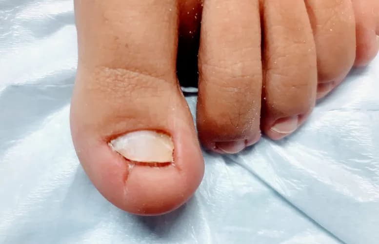 Протезирование и уход за ногтями от профессионалов