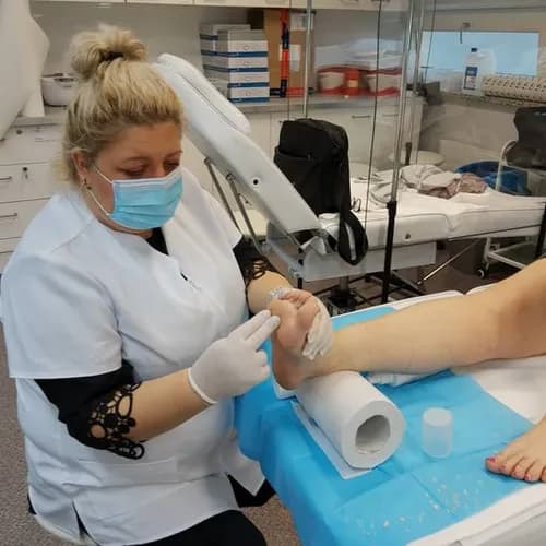 Profesjonalne usuwanie odcisków bez śladu