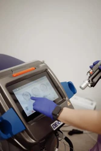 Laserowe usuwanie włosów nad wargą
