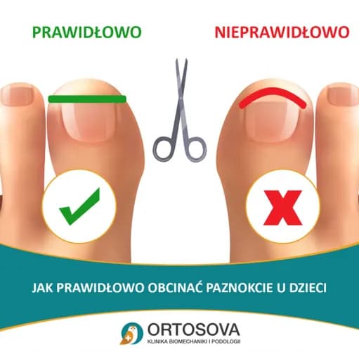 Nasi specjaliści - leczenie brodawek stóp z gwarancją rezultatów