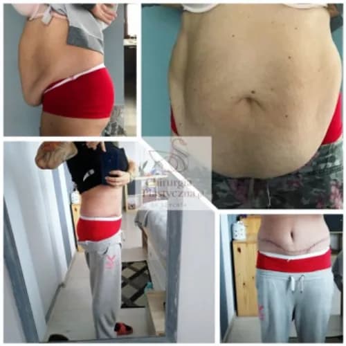 Dietetyk-konsultant: opracowanie jadłospisu na miesiąc