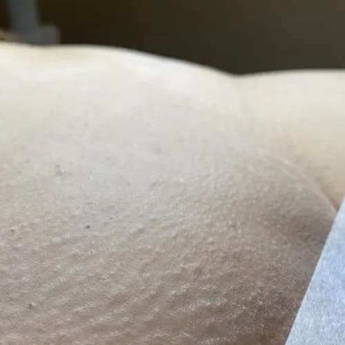 Komfortowy shugaring klasycznego bikini. Doświadczony specjalista