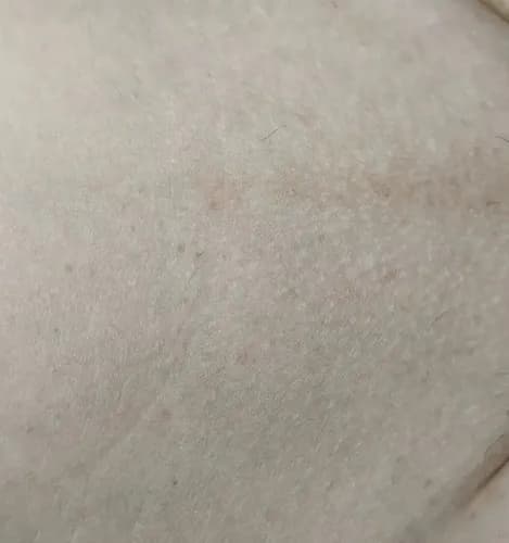 Деликатная эпиляция сахаром