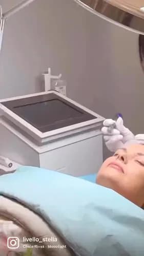 Profesjonalna mezoterapia. Transformacja skóry