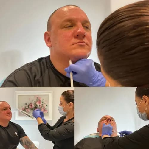 Profesjonalna mezoterapia. Transformacja skóry