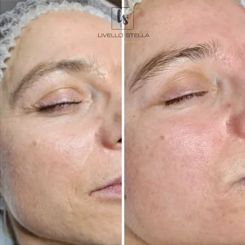 Pomożemy Ci znaleźć idealny kształt dla Twoich brwi.