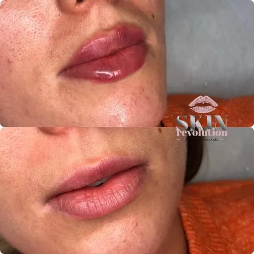 Tatuaż ust z rozprowadzaniem