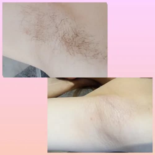 Дбайливий шугаринг пахв