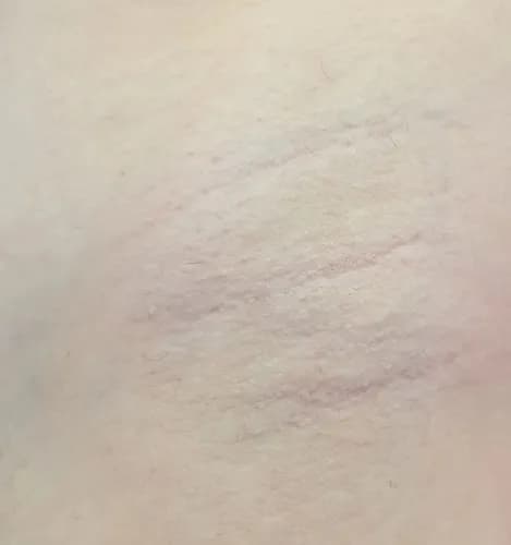 Profesjonalna pielęgnacja: depilacja cukrowa delikatnych okolic