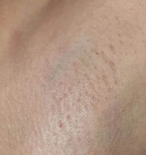 Profesjonalna pielęgnacja: depilacja cukrowa delikatnych okolic