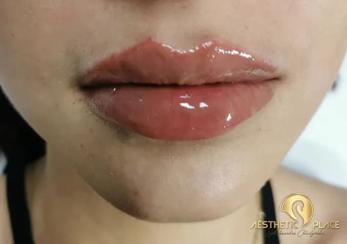 Uwodzicielskie usta bez efektu kaczki. Nowoczesne podejście