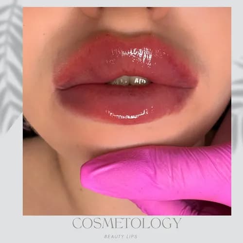 Powiększanie ust z zachowaniem naturalnych proporcji