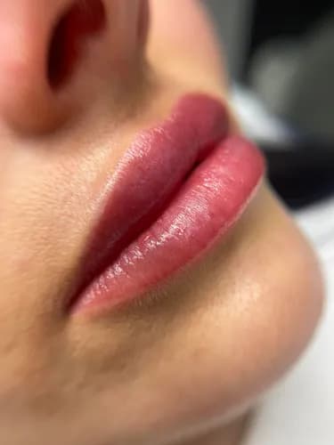 Piękne usta bez operacji. Szybki efekt