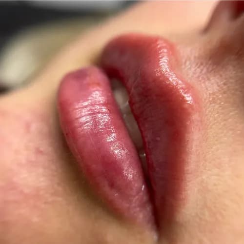 Piękne usta bez operacji. Szybki efekt