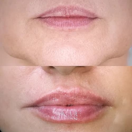 Modelowanie zmysłowych ust. Indywidualne podejście