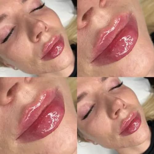 Metamorfoza ust bez rekonwalescencji. Natychmiastowy efekt