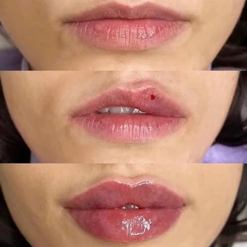 Idealny kontur ust. Nowoczesne metody