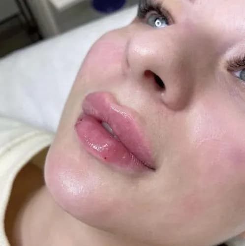 Idealny kontur ust. Nowoczesne metody