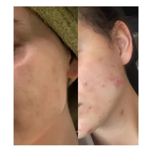 Przemiana bez operacji