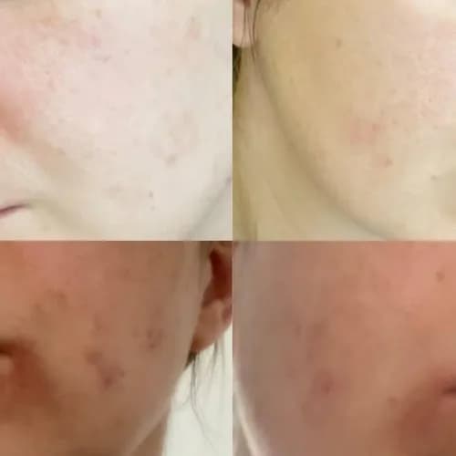 Przemiana bez operacji