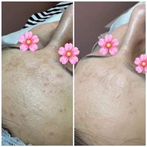 Nawilżanie i odżywianie