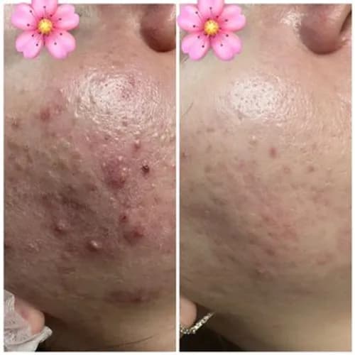 Nawilżanie i odżywianie