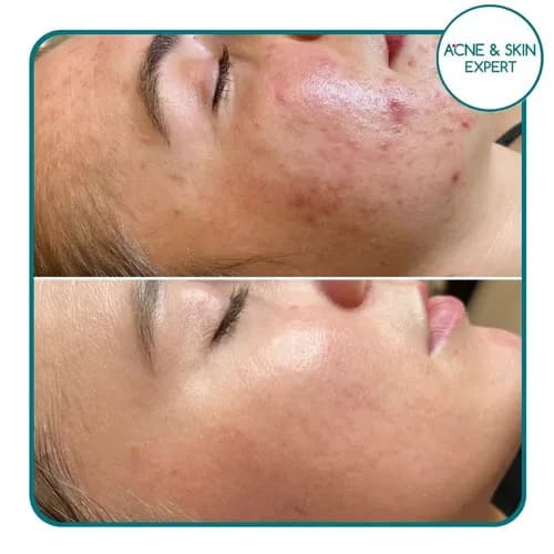 Sekret wiecznej młodości