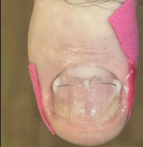 Избавляем от отслоения ногтей. Проверенные методы