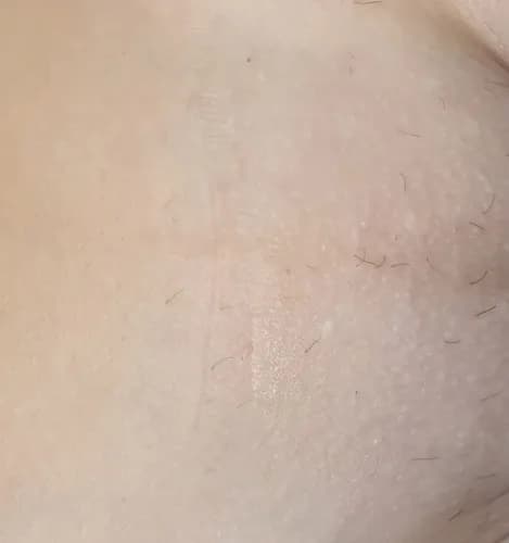 Delikatny shugaring: bezbolesne głębokie bikini.