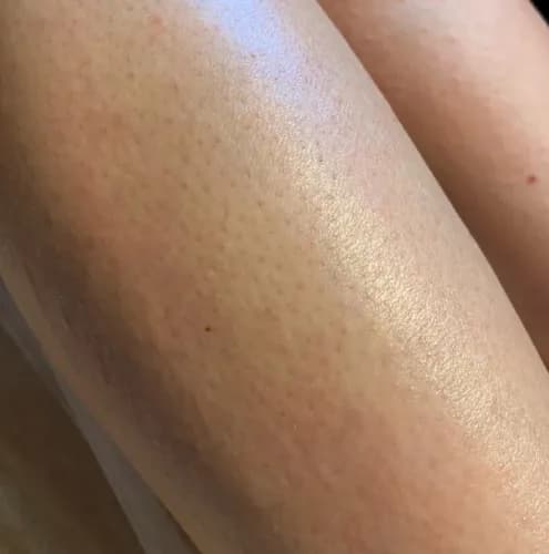 Шугаринг голеней и бедер: идеальный результат