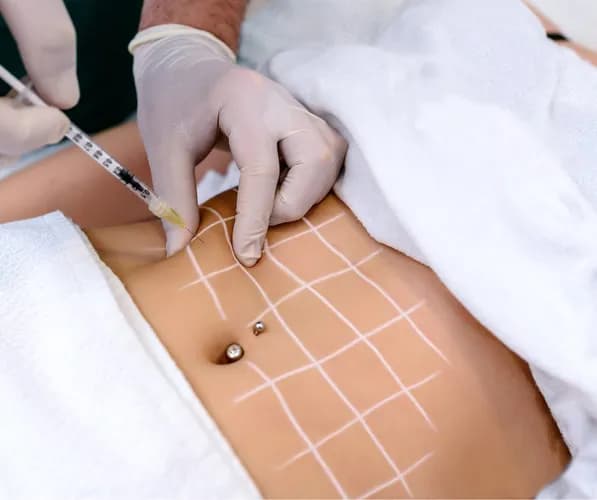 Lifting twarzy bez skalpela