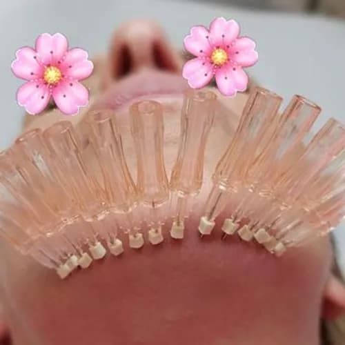 Nici liftingujące – naturalny efekt