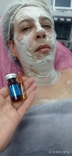 Zdecyduj się na peeling chemiczny!